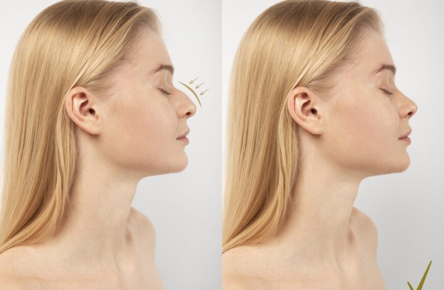 Is a Nose Job in Dubai the Best Choice for Enhancing Your Features?